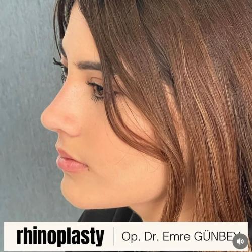 Before after photos of our patients 6